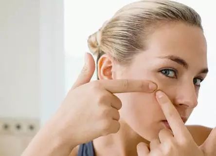 祛痘误区以及祛痘方法