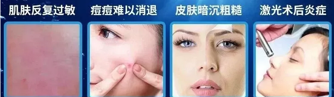 医用冷敷贴适用的肤质人群